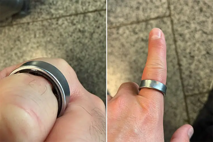 Samsungs Galaxy Ring svällde – YouTuber fick åka till sjukhus